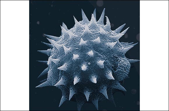 Increased Risk of Allergies for Residents in Saudi Arabia if Hidden Dust is Left Behind